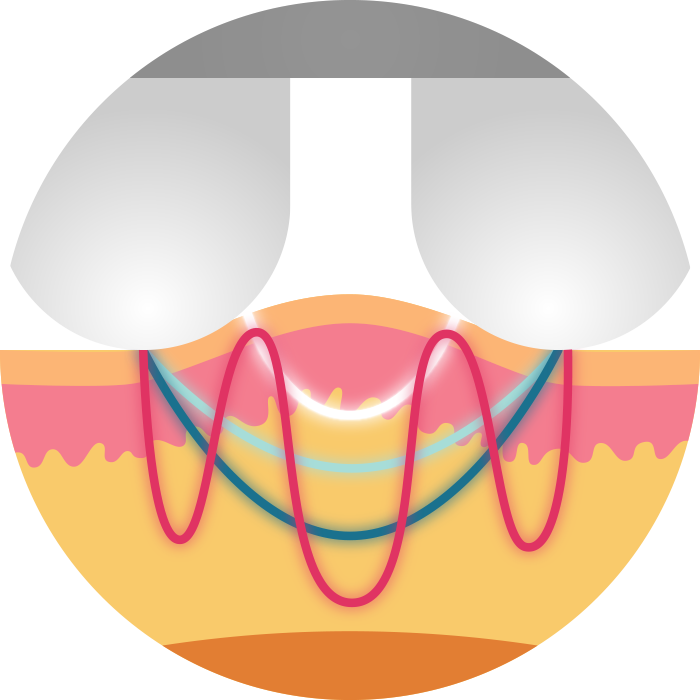 CrioFrecuencia RadioFrecuencia Diagram